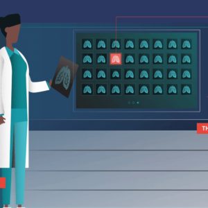 AI algorithm